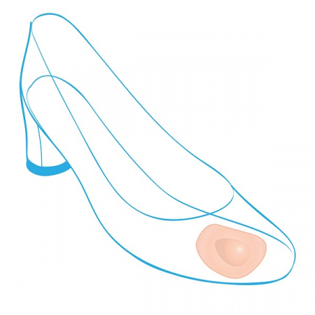 Подушечки ортопедические для стоп Крейт С-120 фото в интернет-аптеке "Фармсервис"