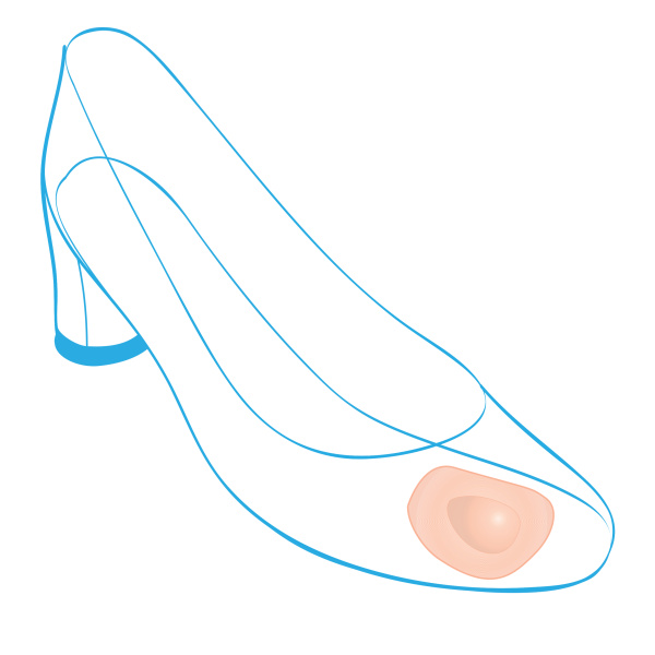 Подушечки ортопедические для стоп Крейт С-120 фото в интернет-аптеке "Фармсервис"